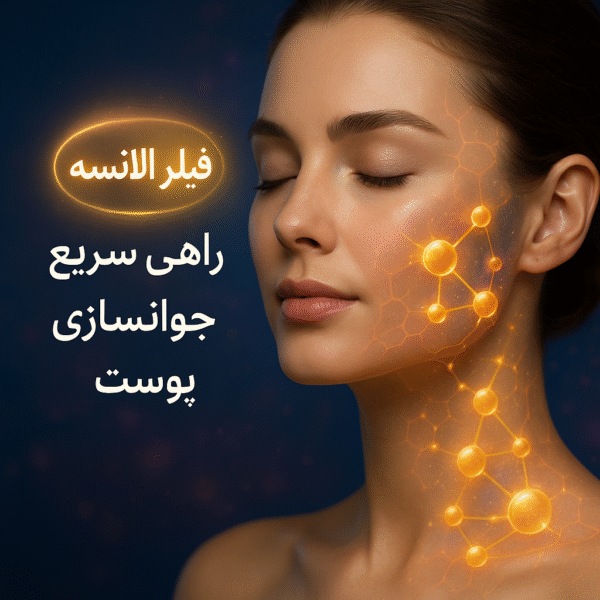فیلر الانسه