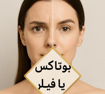 بوتاکس و فیلر