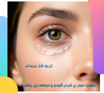 گودی وسیاهی زیر چشم