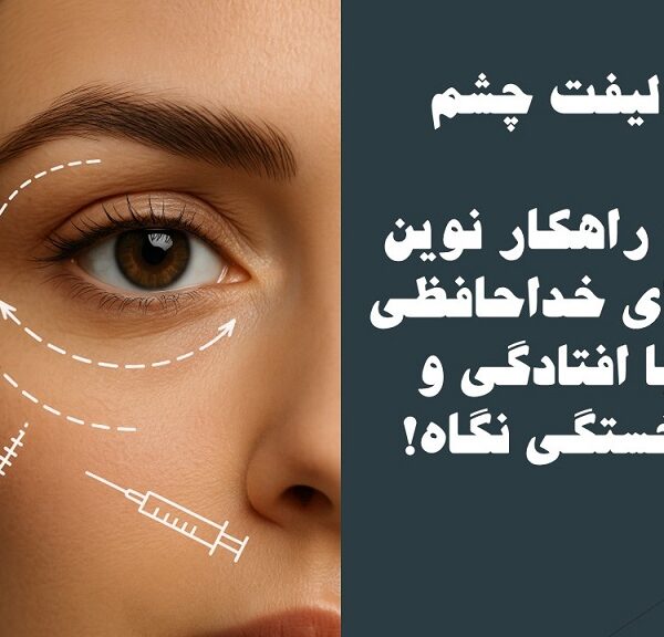 لیفت چشم
