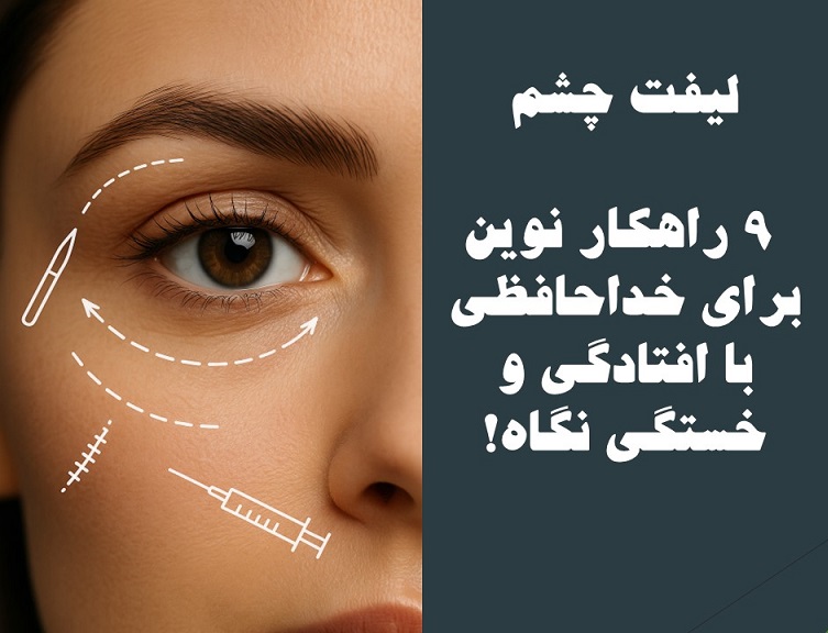 لیفت چشم